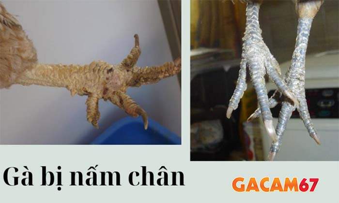 Cách phòng ngừa bệnh nấm chân ở gà Cách phòng ngừa bệnh nấm chân ở gà